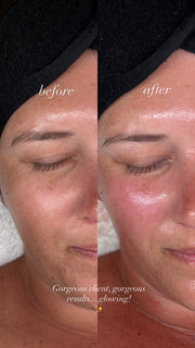 75 Minute | Custom Sculpt & Lift Facial