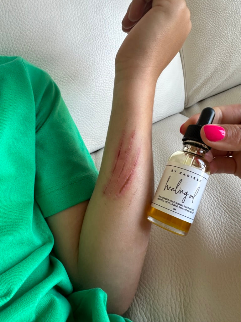 Healing Oil | Tend