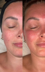 75 Minute | Custom Sculpt & Lift Facial