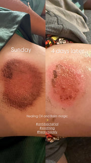 Healing Oil | Tend