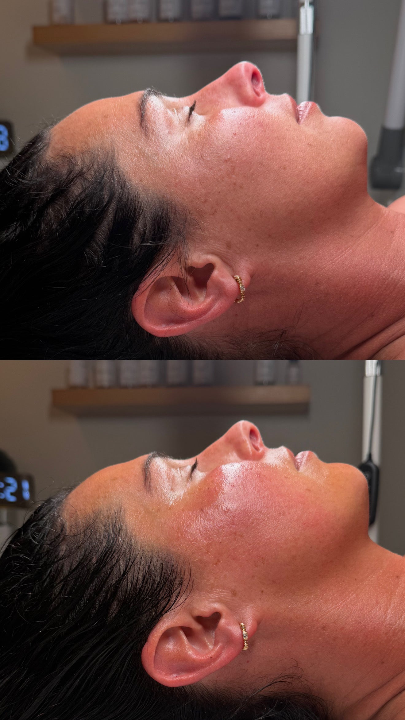 90 Minute | Custom Restorative Facial