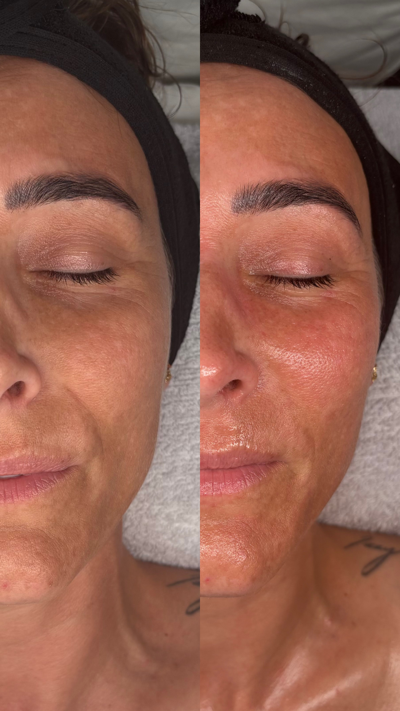 75 Minute | Custom Sculpt & Lift Facial