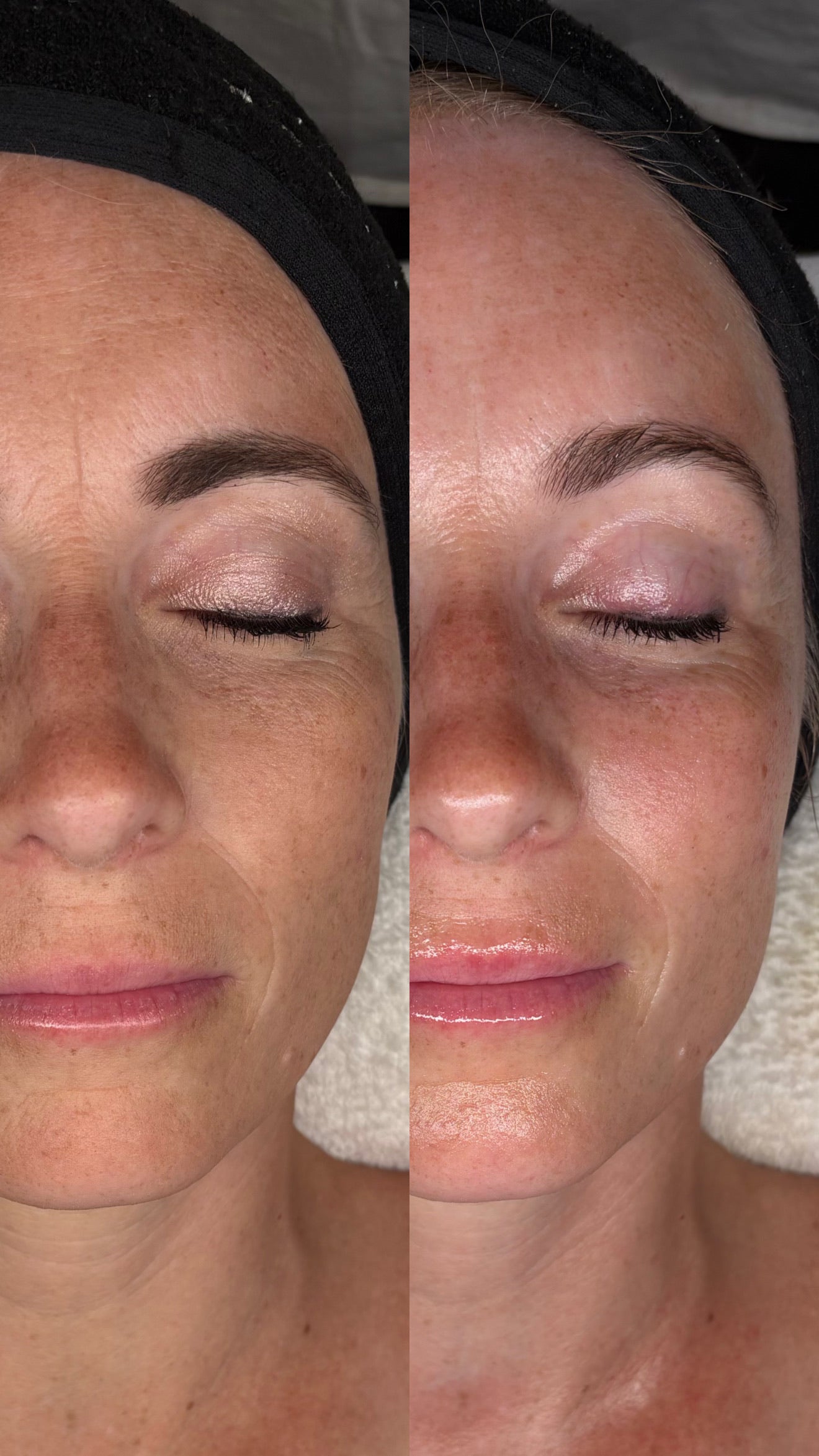 60 Minute | Custom Signature Gua Sha Facial