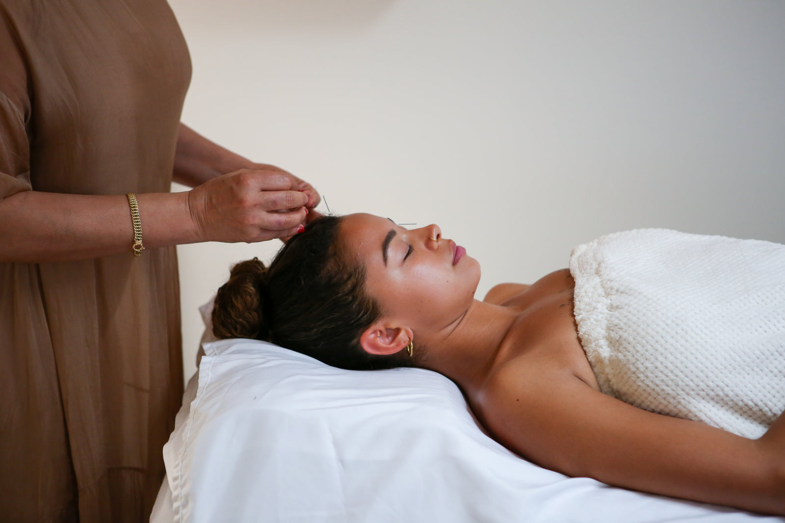 Holistic Acupuncture