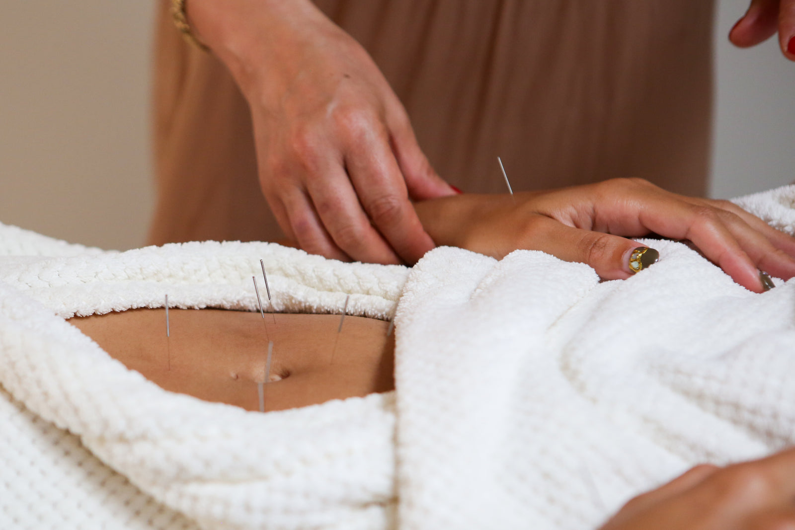 Holistic Acupuncture