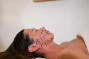 Cosmetic Acupuncture