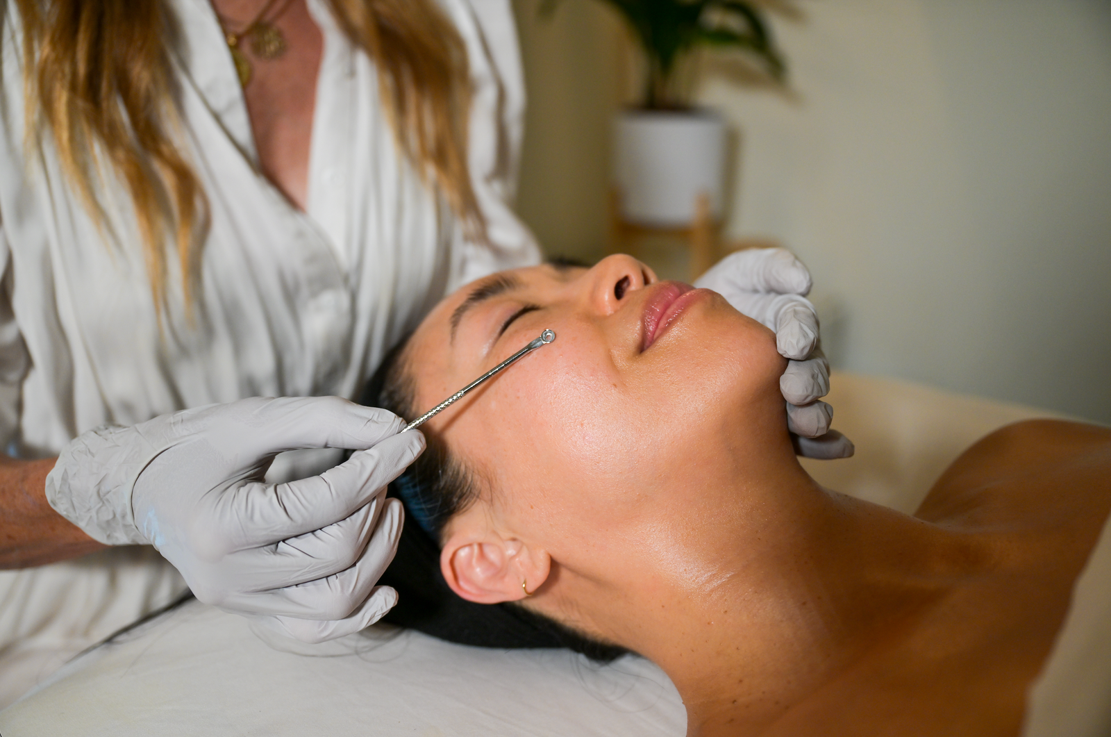 Custom Acne Facial