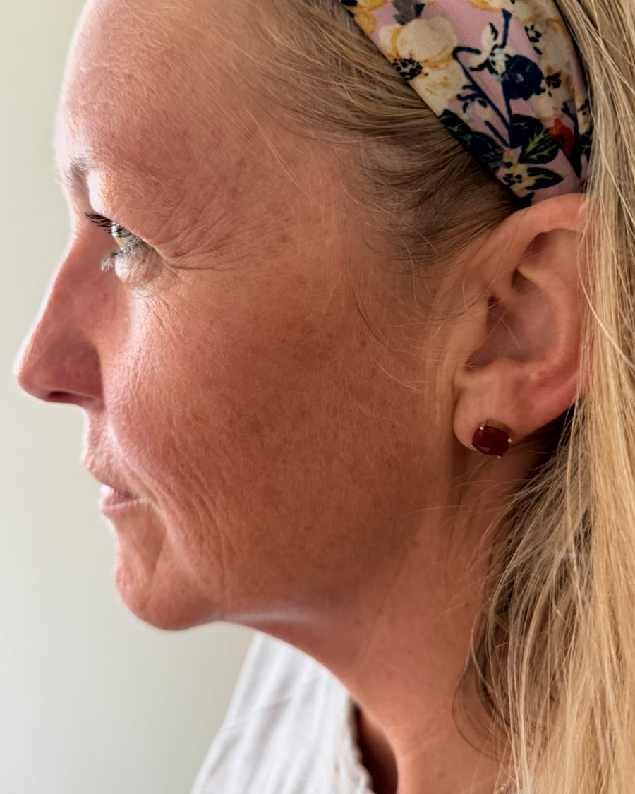 Katie, after, side profile