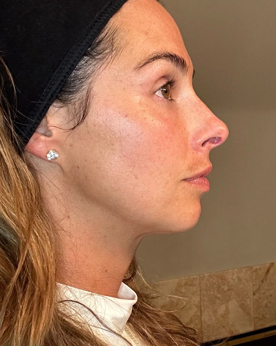 Ryan, after, side profile
