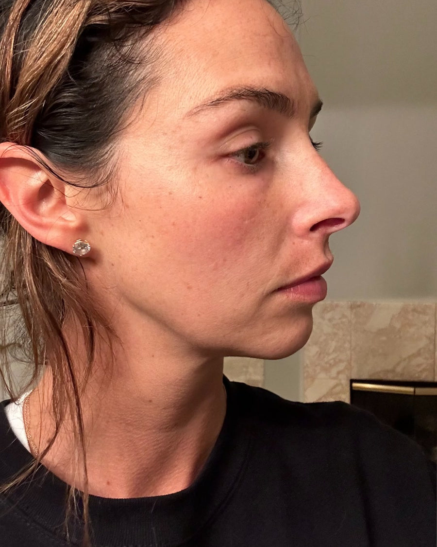 Ryan, before, side profile