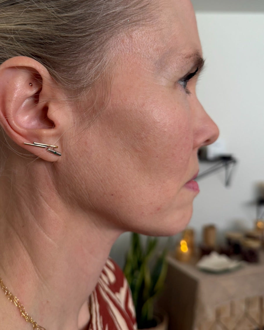 Sarah, before, side profile
